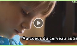cerveau-autiste cerveau-autiste